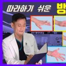 방아쇠수지증후군 치료 스트레칭 손가락통증 운동 이미지