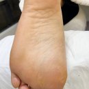 레푸스 연산점 이미지