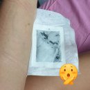 퍼블릭팜 주식회사 | 아침이 피곤하다면 태국 란나풋패치 발패치 수액패치 강추 드립니다. (후기감사합니댱..)_