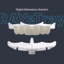 레이솔루션 이미지