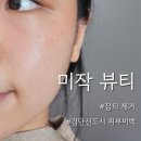 미작뷰티 | 검단신도시 사거리 피부관리 주근깨 제거하고 왔어요
