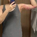 피팅의원 이미지