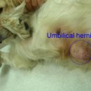 제대 허니아(umbilical hernia) 이미지