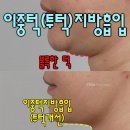 투턱 이미지