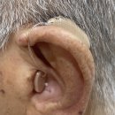 야탑보청기 난청센터 | 수원보청기 찾다가 더365보청기 수원난청센터 방문해본 후기