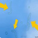 닥터아이씨엘안과의원 | [닥터ICL안과의원] 렌즈삽입술 후기