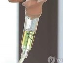 링거 이미지
