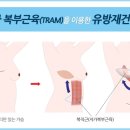 유방 이미지
