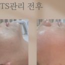 에스떼2 이미지
