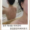 나를위한날e~쁘다에스테틱 | 청주 복대동 피부관리 등집중관리 쏙쏙케어 나를위한날e쁘다에스테틱