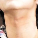 김은영유외과 네이버블로그