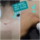 야놀자뽑기샵 | 라라소닉 통증완화에 도움을주는 가정용의료기기
