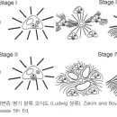 원발성 담즙성 담관염(PBC, primary biliary cholangitis) 이미지