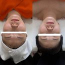 일랑이다 | 경기도 평택 일랑엔뷰티 에스테틱