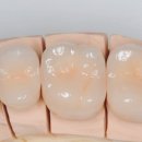 미소치과기공소 이미지