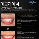 목동중앙치과병원 이미지