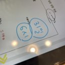 옐로우 성형외과 쌍커풀 수술 후기 자연유착 윗트임 뒷트임 밑트임