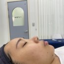아중리 인후동피부관리 여드름케어 소개해요
