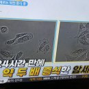 암이란?/위암수술 후 식도염 처방/기치유센터 이미지