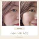 덕양피부관리 다솜에스테틱 화정점 물방울 LDM 솔직후기