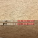 둘리한의원 | 대구차병원 습관성유산 극복(3번 유산), 자궁중격 제거시술과 임신성공기 2탄