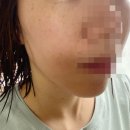 지지재 | [필로드] 대구동성로 필로드 &#34;대구동성로예쁨주의쁨의원&#34;