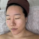 당진 속 연 그리고 연 | 신부관리 물광 피부 만들기 물방울리프팅 분당 미금역 채비연