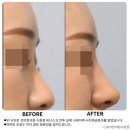 로아한의원 네이버블로그