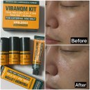 (주)지성 | VIBANQM KIT 비반콴트망카 키트 내돈내산 후기❤️지성피부스피큘 사용효과
