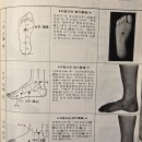 舌炎(설염)이나 重舌일때 然谷穴을사용하면 효과가 았다 이미지