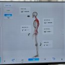 더바디쉼의원 | 대구 바디쉼 재활운동센터에서 모티피지오 체형평가 받아본 후기