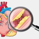 경화헬스 이미지