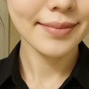 브이케어 | 마마케어 브이쎄라 ems 내돈내산 한달 후기 (팔자주름, 턱선)