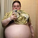 "아이 10명 임신한 느낌"…47kg '난소낭종' 제거한 20대 여성 이미지