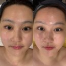 안산피부관리 윤곽관리 살롱드보떼 안산점