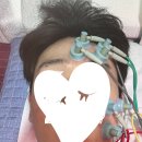 3H대전노은센터 | 대전 안검하수(눈 처짐) 한의원 후기* 노은 OOO한의원 실제 경험담 (마지막에 병원공개)