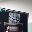 나비온치과의원 이미지