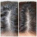 에츠하임 | 탈모전용앰플, 더이상 속지 마세요 에츠하임 모나리로 고민 종결합니다