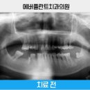 에버플란트치과의원 네이버블로그