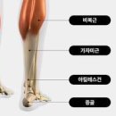 발바닥 통증 있을때 원인 발앞쪽 발뒤꿈치 발끝 발중앙 아킬레스건 이미지