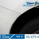 덴트존 이미지
