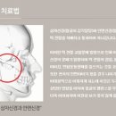 아름턱한의원 이미지