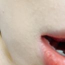 덕인건강원 | 입술 옆 찢어짐 엄청 아리잖아요