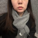 유라인 | 유라인 윤곽주사 심부볼 브이컷주사 4회차 후기