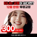가인의원 | 대전 치아교정 가격 자연스러운 치아 복원