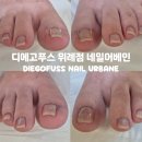 네일어베인 디에고푸스 파고드는 내성발톱 관리 솔직후기
