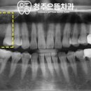 청주으뜸치과의원 이미지