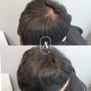 일산두피&눈썹단미토탈뷰티