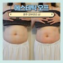 다미인피부비만관리 | 광주 운암동 피부관리샵 에스테틱 오프 비만관리 후기