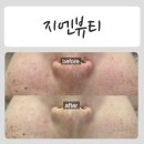 (주)지엔 | 지친 피부를 환하게! 꼼꼼하고 특별한 춘천피부관리" 지엔뷰티 "